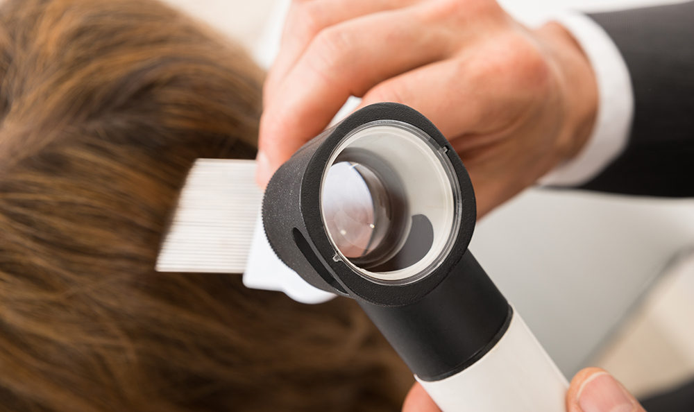 injerto capilar con técnica FUSS o de la tira