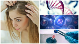 Se están llevando a cabo ensayos clínicos con células madre para evitar la caída del pelo.