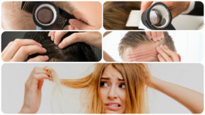 El injerto capilar es hoy en día la solución más eficaz y definitiva a la caída del cabello.