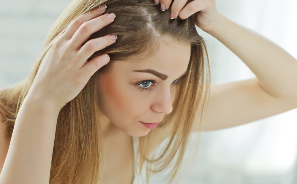 Existen diversos tratamientos para evitar la caída del pelo en mujeres