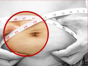 No basta con padecer sobrepeso para considerarse un candidato idóneo a la cirugía de la obesidad.