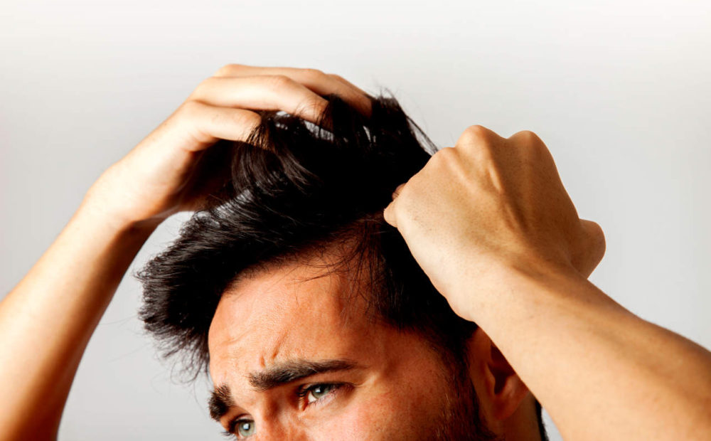 Caída del pelo o alopecia