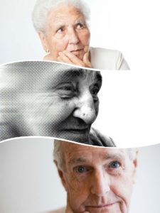El Alzheimer es una enfermedad que requiere una serie de pruebas para llegar a su diagnóstico además de la propia exploración clínica