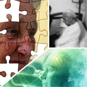 Cabe la posibilidad de que este trastorno se presente junto a la enfermedad de Alzheimer.