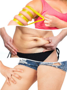 Brazos, abdomen y muslos son zonas que pueden tratarse en una liposucción.