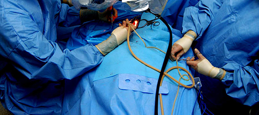 Inyección de grasa extraída en la liposucción