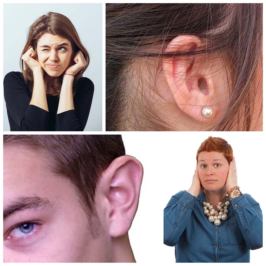 Las cicatrices son casi imperceptibles y quedan ocultas detrás de las orejas.