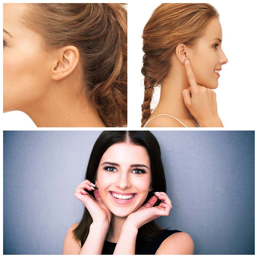 La operación de otoplastia no perjudica a las facultades auditivas.