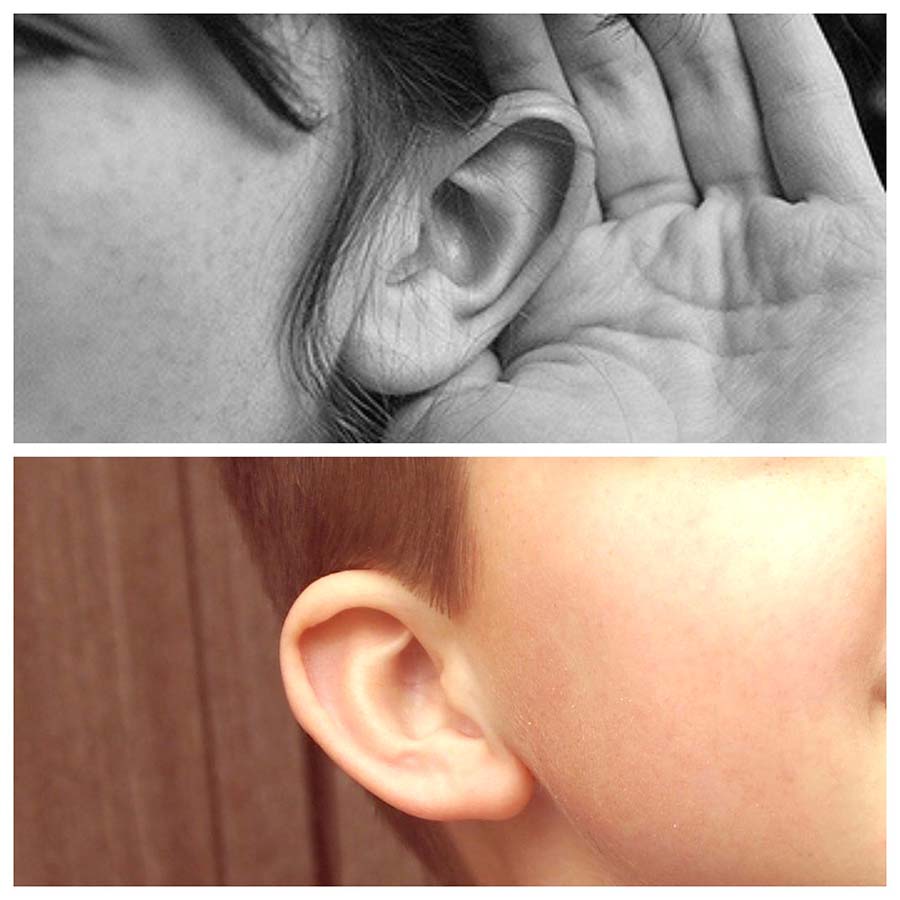 El riesgo más común de la otoplastia es el de las infecciones que se solucionan con la medicación adecuada.