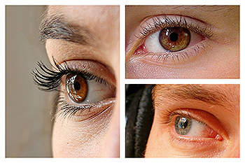 La mayoría de las complicaciones, si se llegan a presentar, son de carácter leve y desaparecen a los pocos días