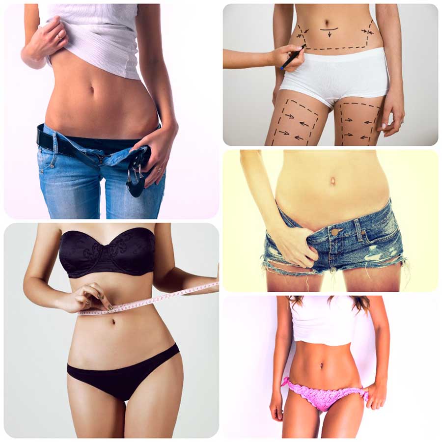 La abdominoplastia en Granada es una cirugía estética con la que se mejora la apariencia de la piel y músculos abdominales.
