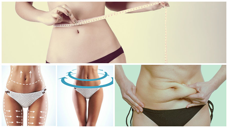 Los resultados de la abdominoplastia en Granada se podrán ir viendo progresivamente.