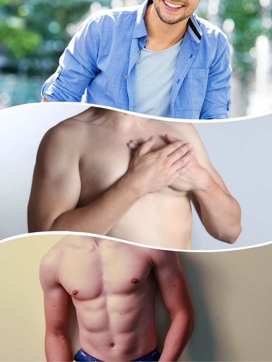 La ginecomastia en hombres puede tener algunos problemas de salud asociados.