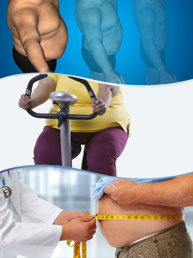 No debe olvidarse que la liposucción en Murcia no supone ningún milagro contra la obesidad, sino que el paciente habrá de poner mucho de su parte.