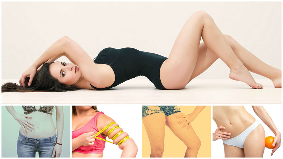 La liposucción o lipoescultura en Las Palmas se puede realizar en brazos, piernas, abdomen, papada, entre otras zonas del cuerpo.