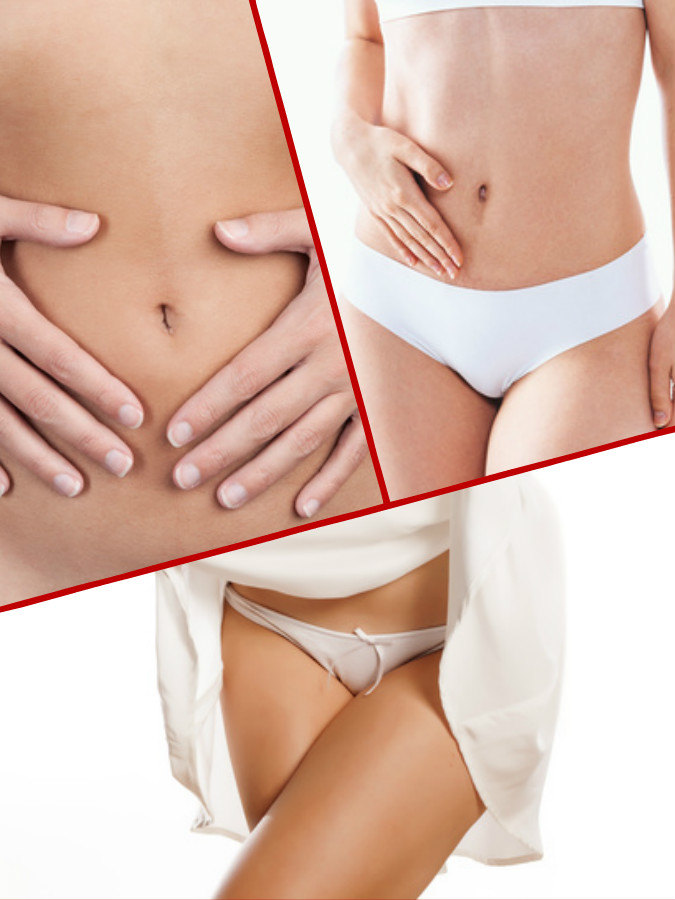 La liposucción en Valencia tan solo precisa de unas pequeñas incisiones para la introducción de las cánulas.