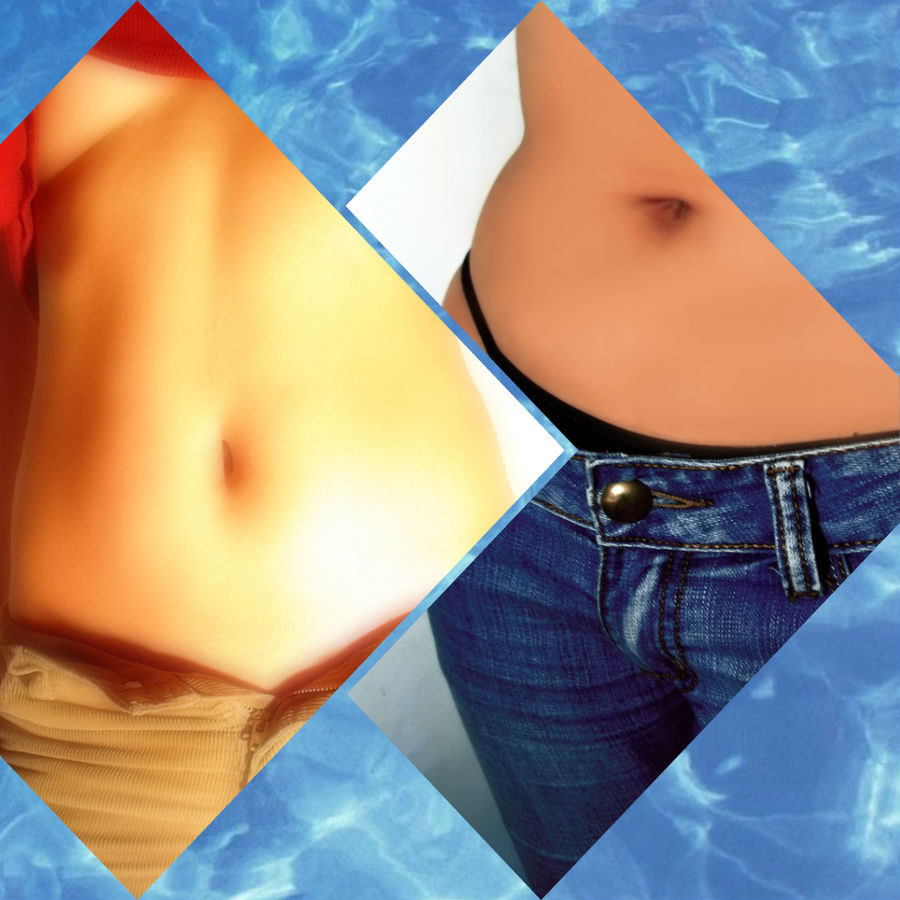 Los resultados de la cirugía suelen ser bastante satisfactorios para quienes se someten a ella.