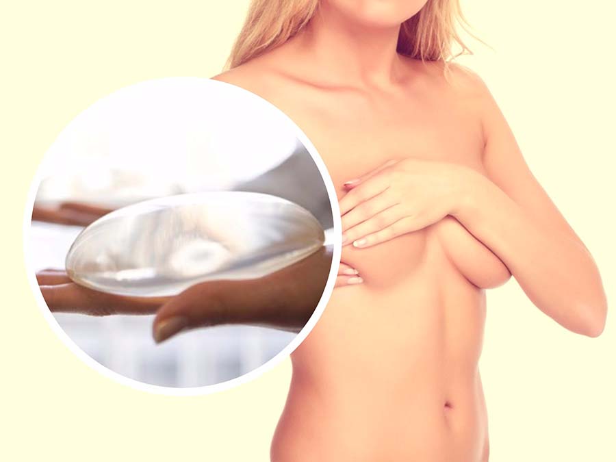 Llevar implantes por un aumento de pecho no dificulta la detección del cáncer de mama.