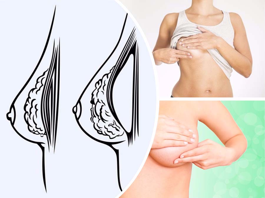 No hay ninguna evidencia científica que avale la relación entre prótesis de pecho y cáncer de mama.